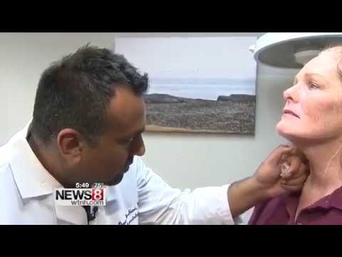 Stamford Dermatologist Demonstrates Kybella New Injection for Double Chin Fat on News 8