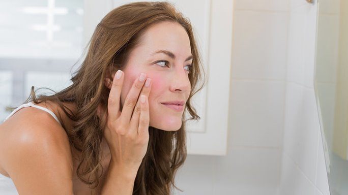All You Need to Know About Rosacea- Causes, Symptoms & Treatments